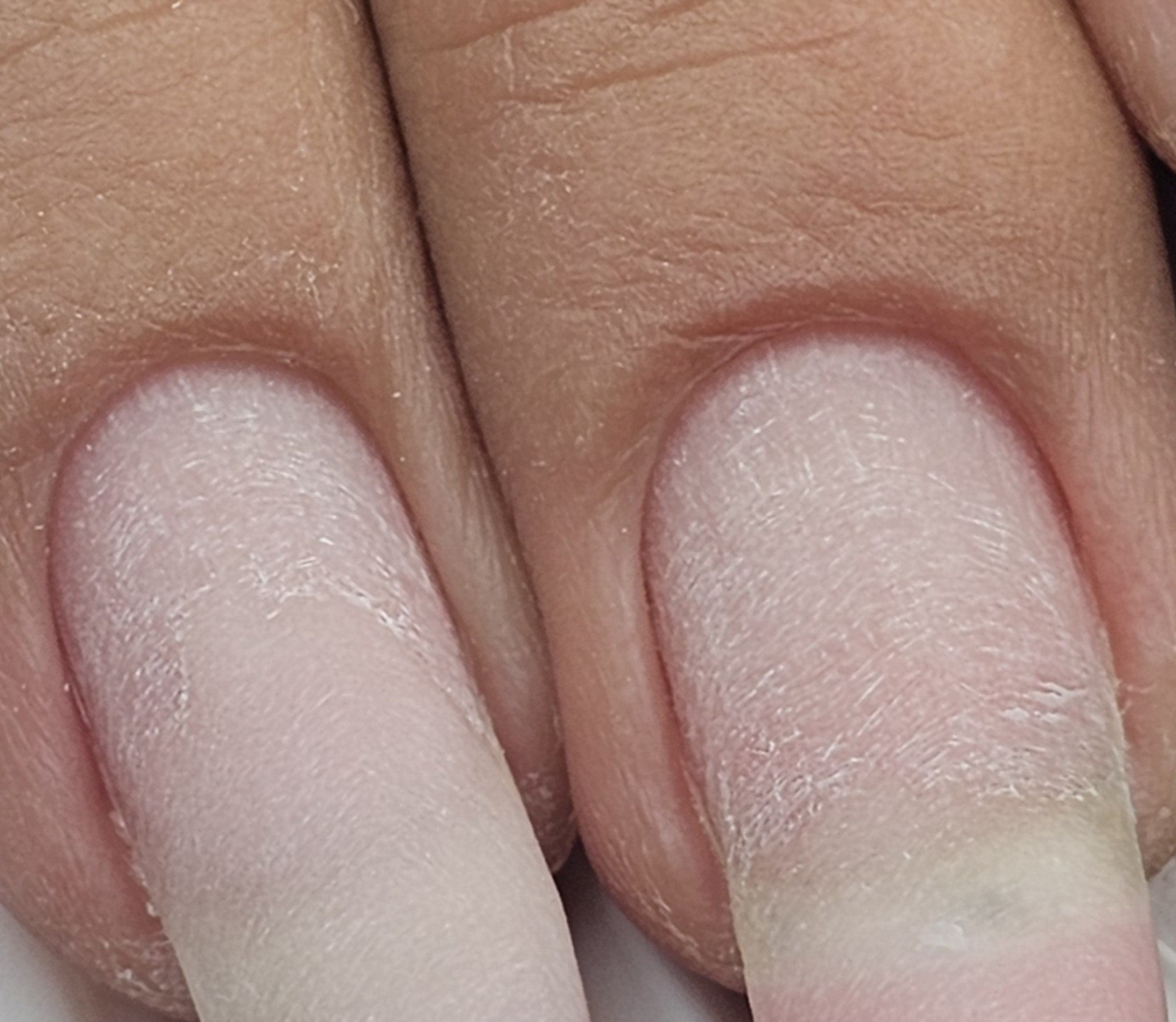 Makroaufnahme von zwei Fingerkuppen mit trocken bearbeitetem Nagelfalz ohne Lack